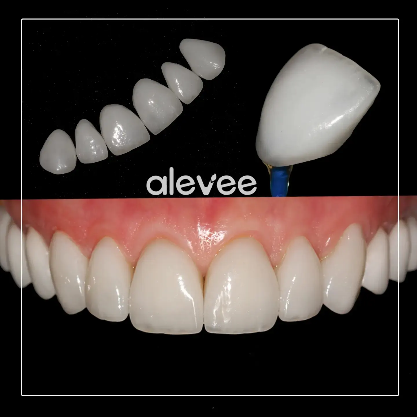 Equipamento odontológico moderno